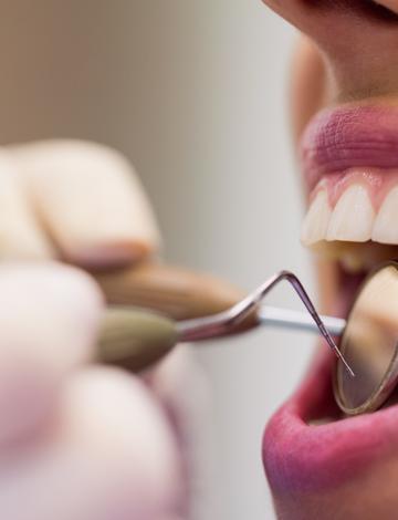 Como remover tártaros e restaurar sua saúde bucal