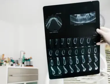 Exames odontológicos: conheça os aliados da sua saúde bucal