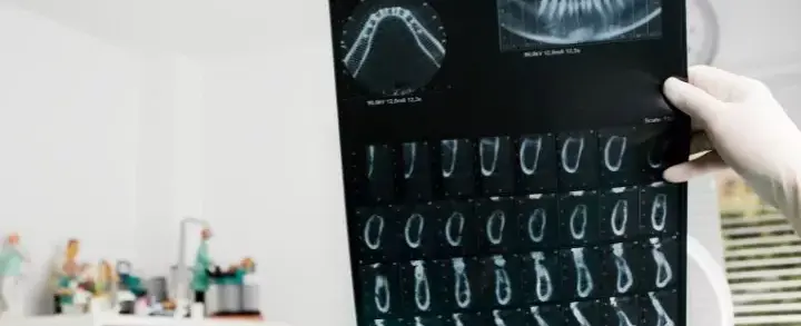 Exames odontológicos: conheça os aliados da sua saúde bucal