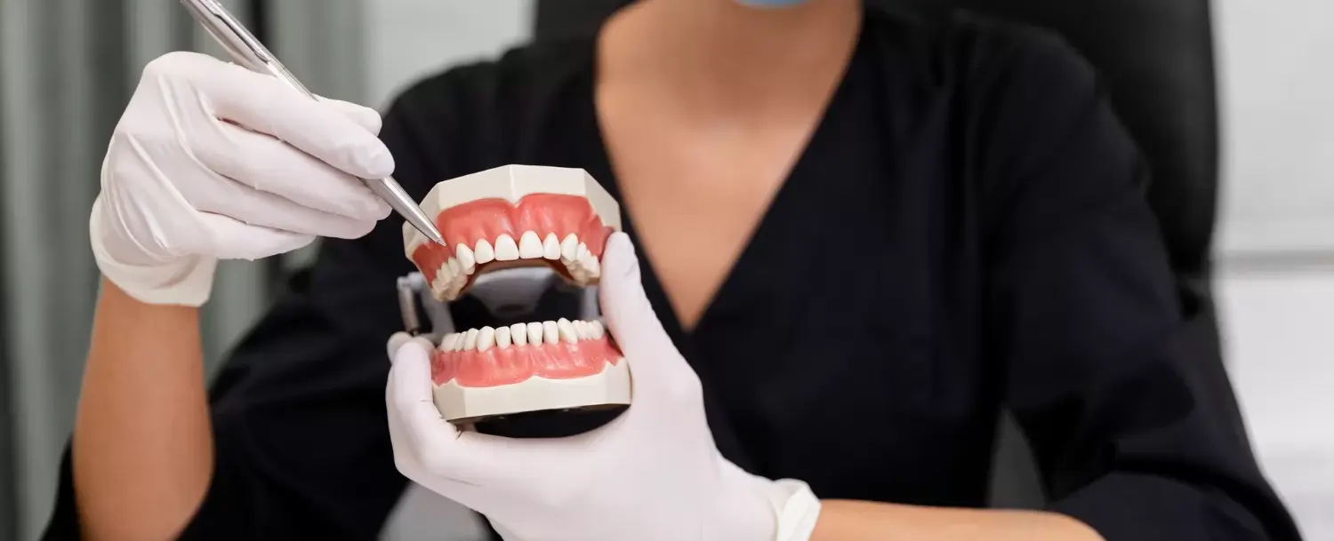 Tipos de prótese dentária moderna: o que você precisa saber antes do tratamento?
