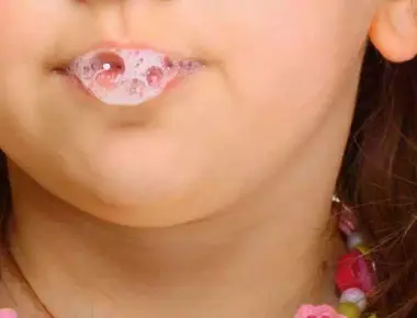 Hipersalivação: tudo o que você precisa saber sobre o excesso de saliva