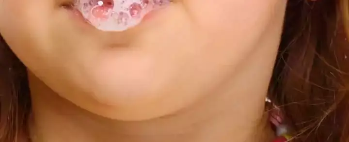 Hipersalivação: tudo o que você precisa saber sobre o excesso de saliva
