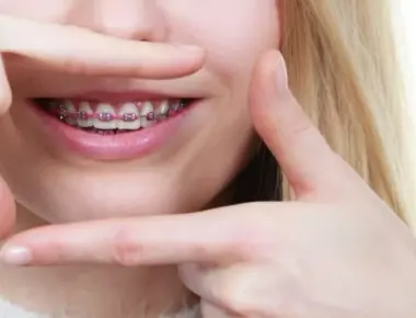Quanto custa um aparelho dentário? Descubra agora mesmo!