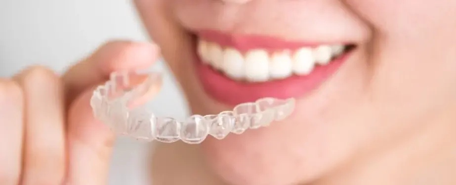 Aparelhos odontológicos: as 7 maiores dúvidas dos pacientes