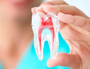 Afinal, o que é fazer canal de dente? Tire suas dúvidas aqui!