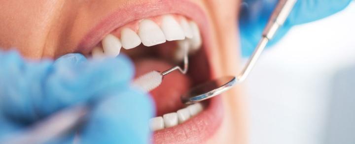 Queimadura na boca: o que fazer para reduzir a dor e acelerar a recuperação?
